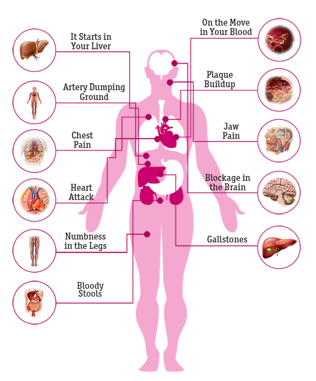 Body Systems Affected - High Cholesterol